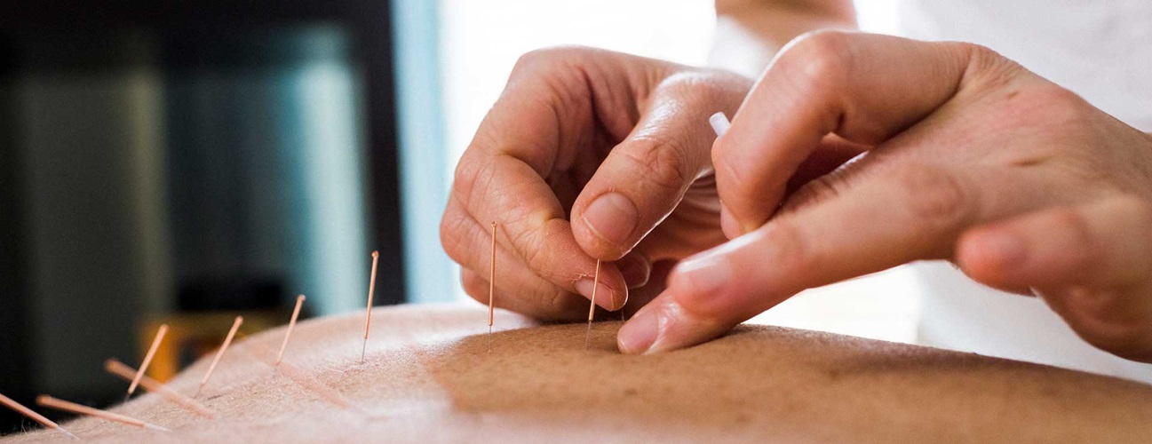Accupressure Therapy